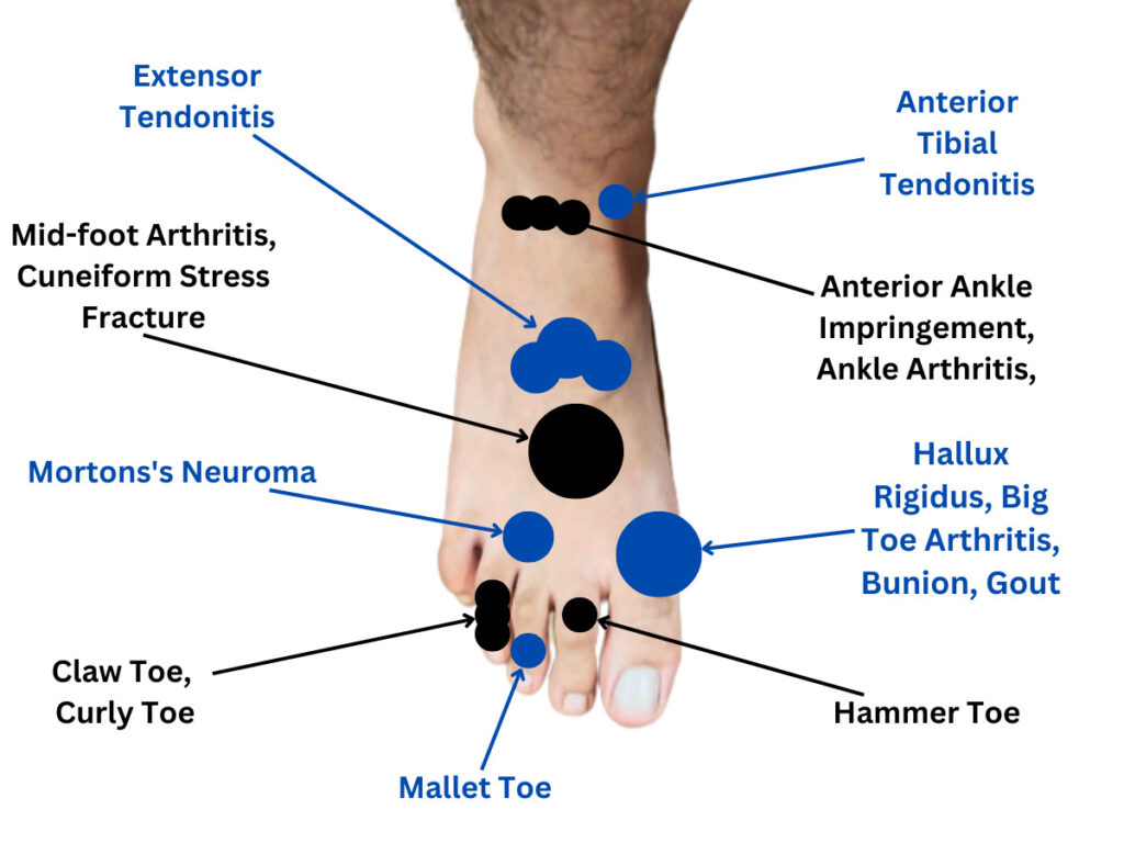 Top Foot Pain Chart