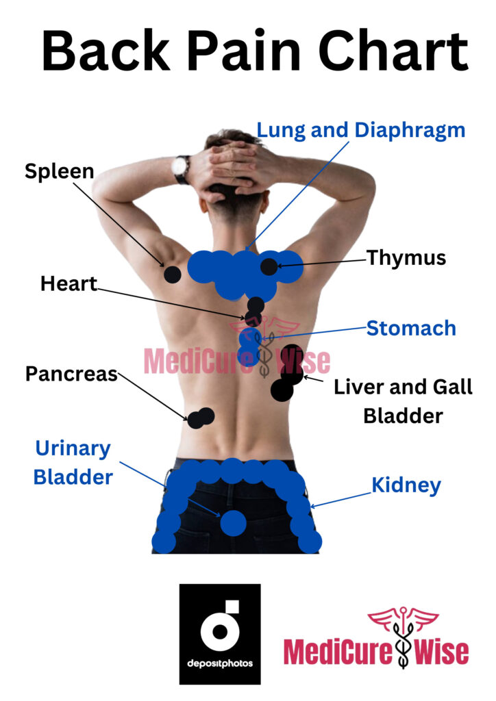 Back Pain Location Chart - referred pain