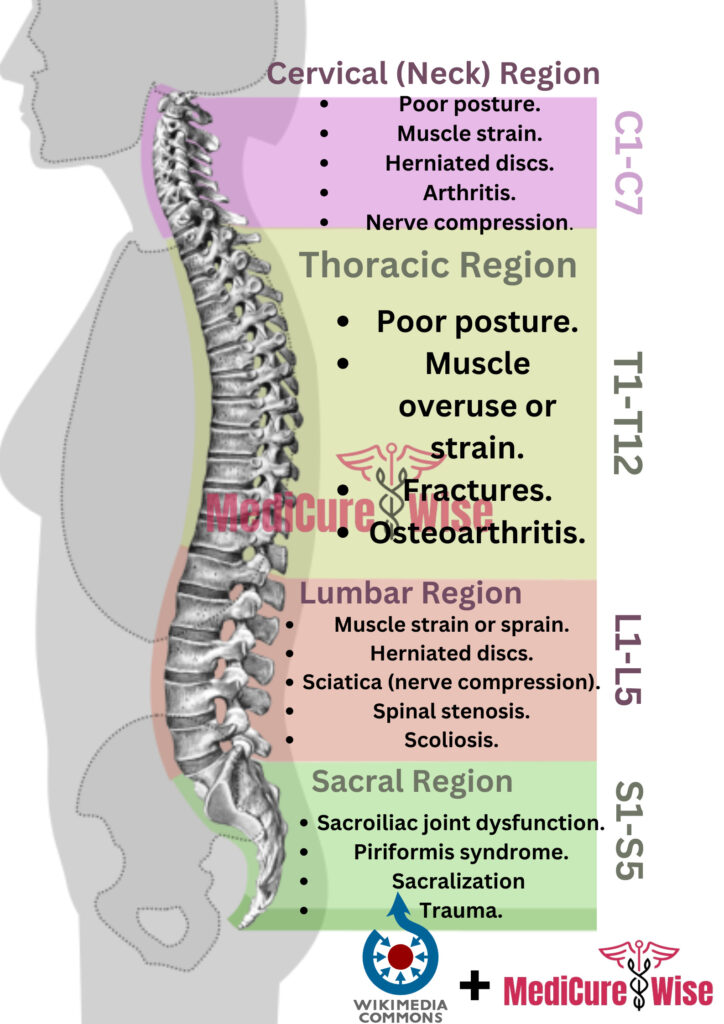 Back Pain Chart - Spine